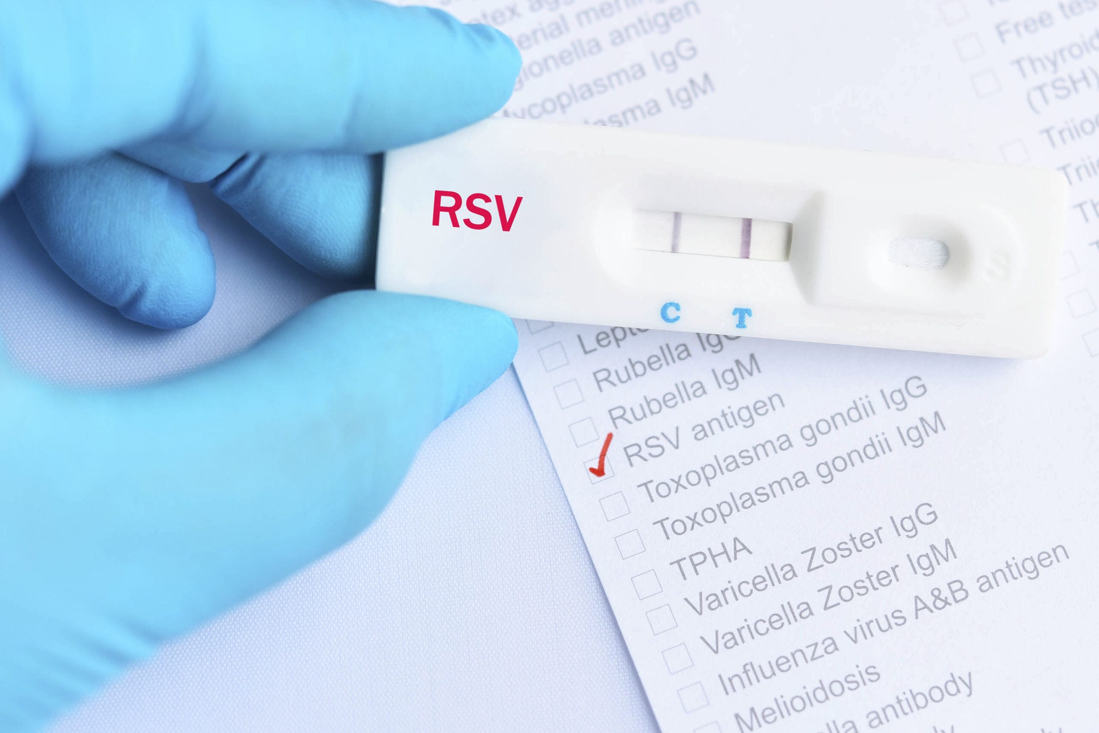 Schnelltest F R Infektionskrankheiten Rsv Biomed Labordiagnostik