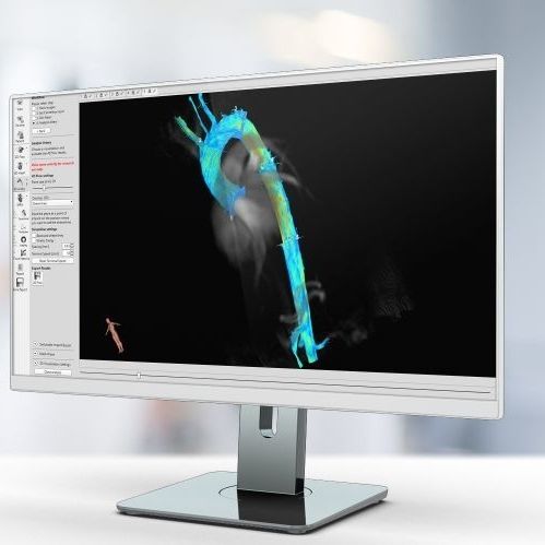 Medizinische Software 4D Flow Pie Medical Imaging für