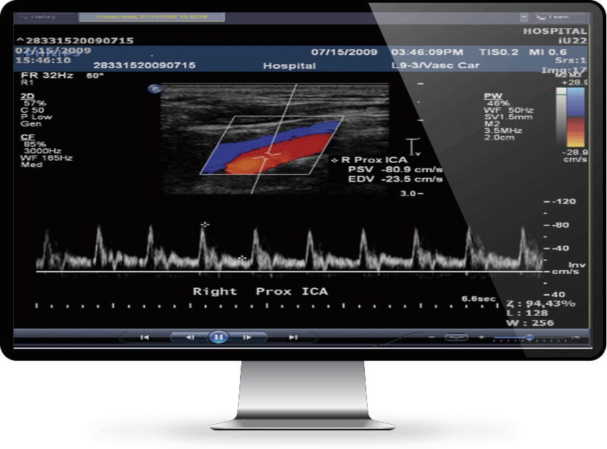 Medizinische Software Infinitt North America F R Krankenhaus