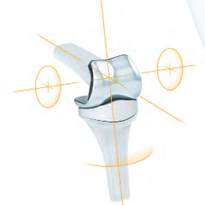 Implantat für Interphalangealgelenk der Hand