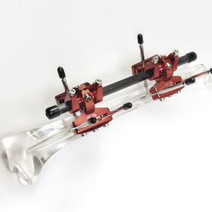 modularer Externfixierer / rohrförmig / für Erwachsene