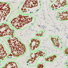 Software-Modul / Onkologie / Visualisierung / Diagnose / für Immunohistochimie