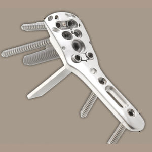 Knochen-Kompressionsplatte / Humerus / proximal