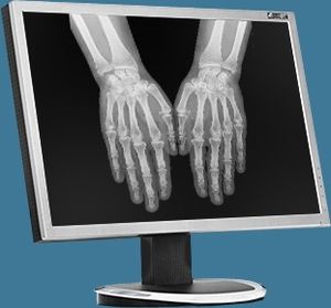 DICOM-Visualisierung-Software / für Interoperabilität / für medizinische Bildgebung / für Röntgenstation