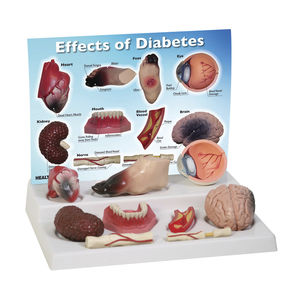 Anatomisches Modell / für Diabetes / Herz / Fuß / Niere