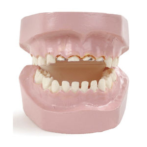 Anatomisches Modell / Gebiss / für Fortbildungen / Pathologie / Baby