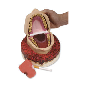 Anatomisches Modell / Gebiss / Zahnfleisch / Pathologie