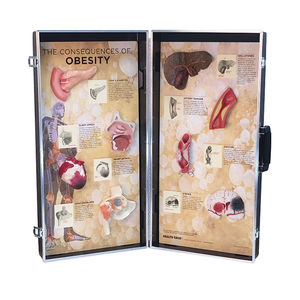 Anatomisches Modell / Nebenhöhle / Gelenk / Leber / Arterie