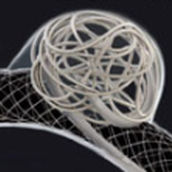 Embolisationsspirale