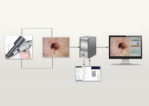 Software für die Hautdiagnose / Dermatologie / für Dermatologieabteilung