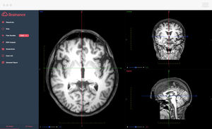 Diagnose-Software / Reporting / 3D-Visualisierung / Planung