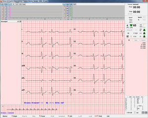 Software-Modul / Analyse / Reporting / Monitoring / Druck