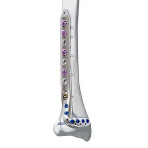 Knochen-Kompressionsplatte / Tibia / medial / distal