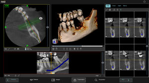 Software / Verwaltung für Patientenberichte / Reporting / 3D-Visualisierung / Simulation