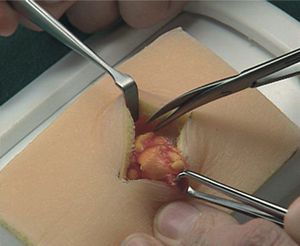Simulator / dermatologische Behandlung / für Chirurgie / Pathologie / Pad