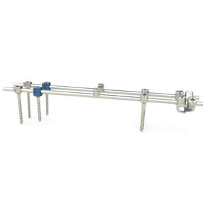 thorako-lumbales Stabilisierungssystem für Osteosynthese / dorsaler Zugang / für Kinder
