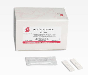 Schwangerschaftsschnelltest / hCG / Urin