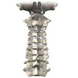 Okzipito-zervikothorakale Stabilisierungssystem für Osteosynthese / dorsaler Zugang / für Erwachsene