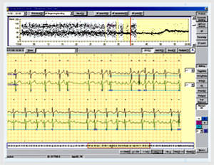 Software für Langzeit-EKG