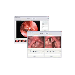Analysesoftware / Visualisierung / für Endoskopie