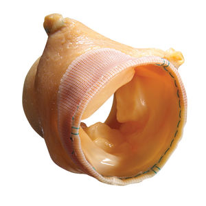 Biologischer Aortenklappenersatz / Aorta / stentlos