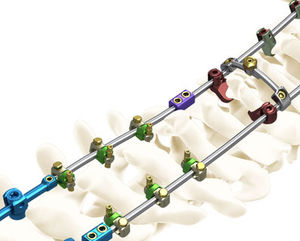 Okzipito-zervikothorakale Stabilisierungssystem für Osteosynthese / posterior / für Erwachsene