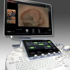 Ultraschallgerät auf Plattform / für Ultraschalldiagnostik Gynäkologie und Geburtshilfe / 3D/4D