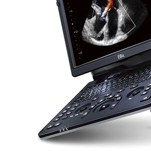 mobiles Ultraschallgerät / für Kardiologie / Farbdoppler / integrierte Konsole