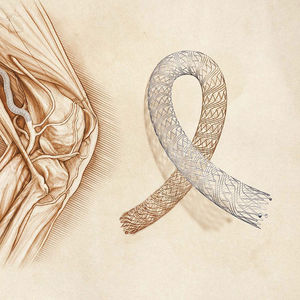 peripherer Stent / Nitinol / Selbstexpandierender
