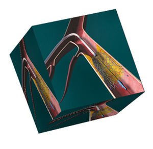 Peripheral-Stent / Nitinol