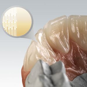 Zahnmedizinisches Material / Zirkon / CAD CAM / hochtransluzent