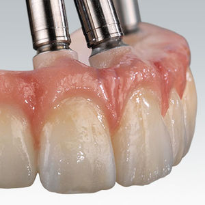 Zahnmedizinisches Material / Zirkon / zur Dentalrestaurierung / CAD CAM / für Zahnbrücken