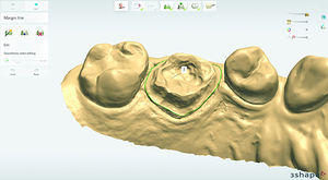 Software für Projektentwicklung / Dental