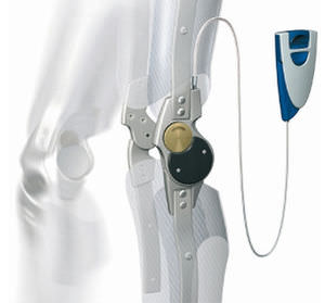 Knieexprothese mit manueller Verriegelung / monoaxial / Standardausführung / für Erwachsene