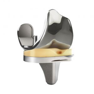 Femur-Patella Knieprothese / Festlager / zementierte