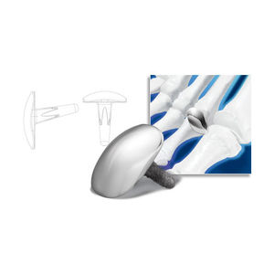 Implantat für Metatarsus-Phalanx