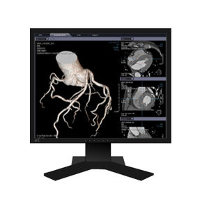 Analysesoftware / 3D-Visualisierung / Diagnose / Bewertung