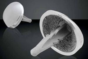 Implantat für Metatarsus-Phalanx