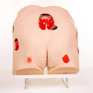 Anatomisches Modell / Lumbosakral / für Dekubitus-Behandlung / Pathologie