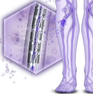 peripherer Stent / Medikamentenbeschichteter