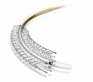 peripherer Stent / Nitinol / Selbstexpandierender