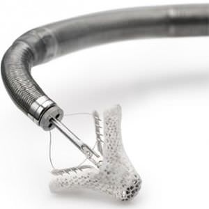 Herz-Reparatursystem / zur Mitralklappenreparatur