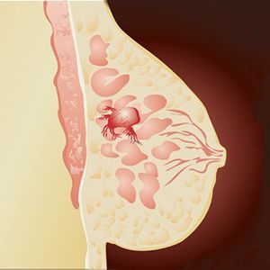 monoklonale Antikörper Laborreagentien / für Immunotestverfahren / CA 15-3
