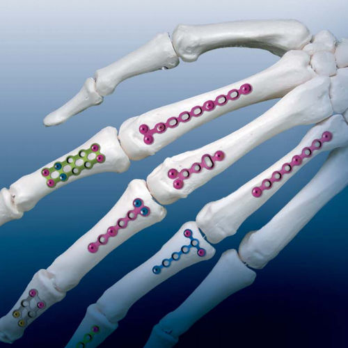 Kompressionsplatte für Fingerglied OSTEONIC Metall