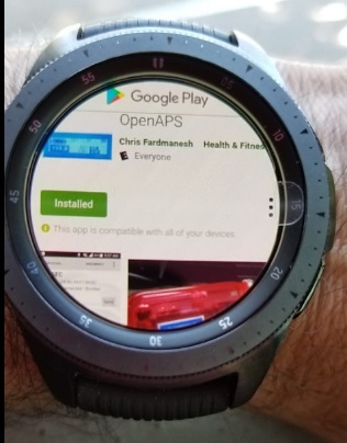 OpenAPS Photo 3