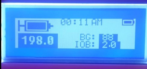 OpenAPS Photo 4