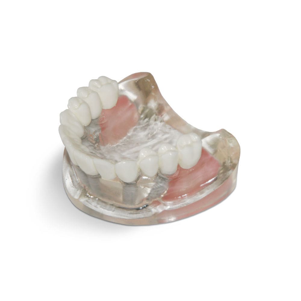 Sinusales anatomisches Modell - T10 - GF DENTAL - Zahn / Oberkiefer