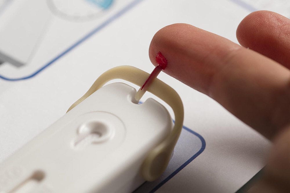 AIDSSchnelltest AtomoRapid™ Atomo Diagnostics HIV / Blut