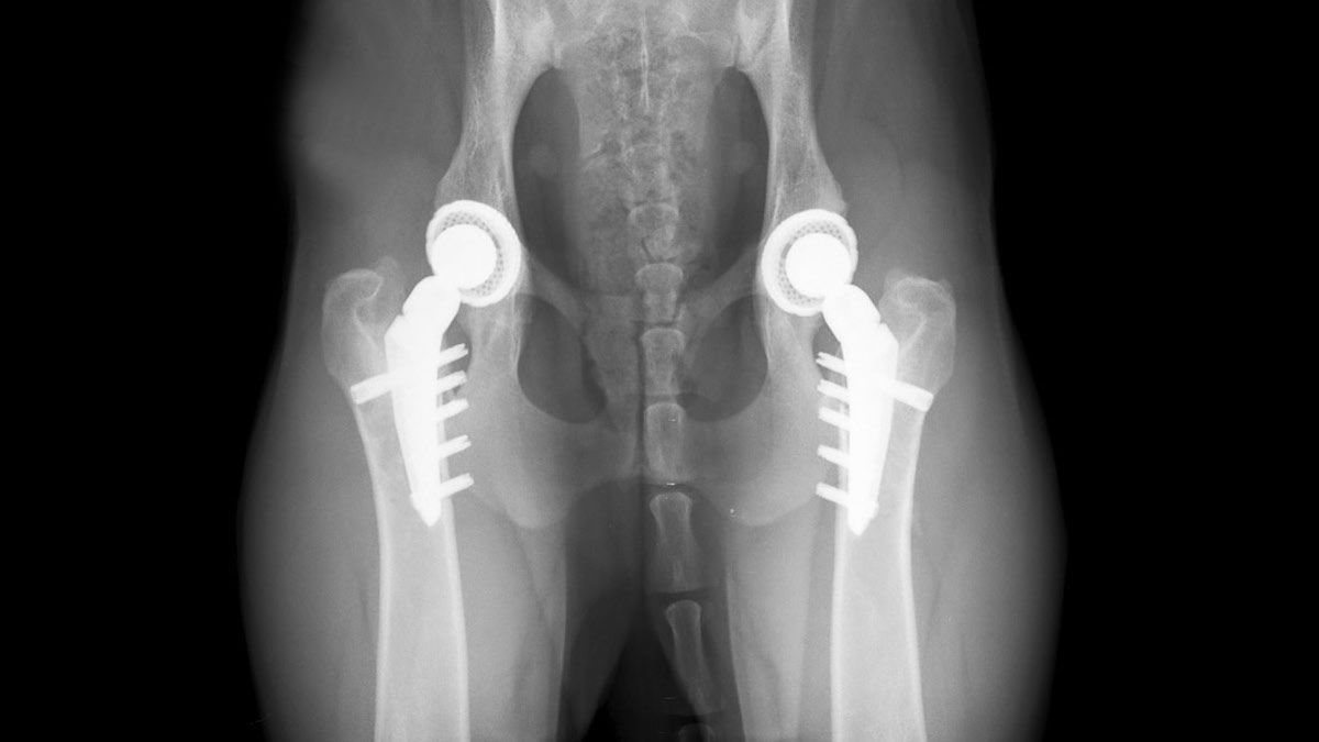 knstlicher darmausgang pflegegrad Enterostoma  PFLEGELERNZETTEL
