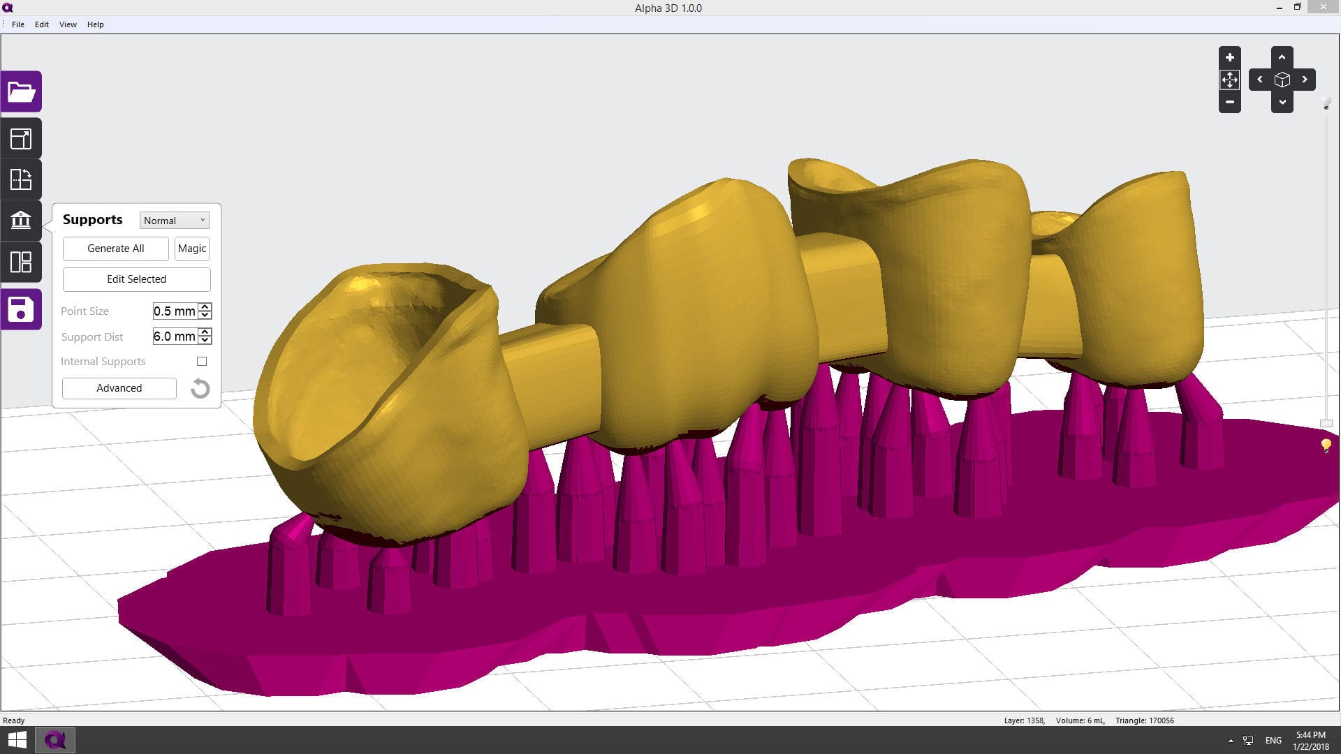 3D-Druck-Software - Alpha 3D - Ackuretta Technologies Pvt. Ltd. - Dental / Dental